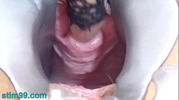 Mature Woman Peehole Endoscope Camera in Bladder with Balls